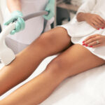 Laser hair removal treatment on a woman’s legs for long-lasting smooth skin at Skin Luxe Medical Aesthetics